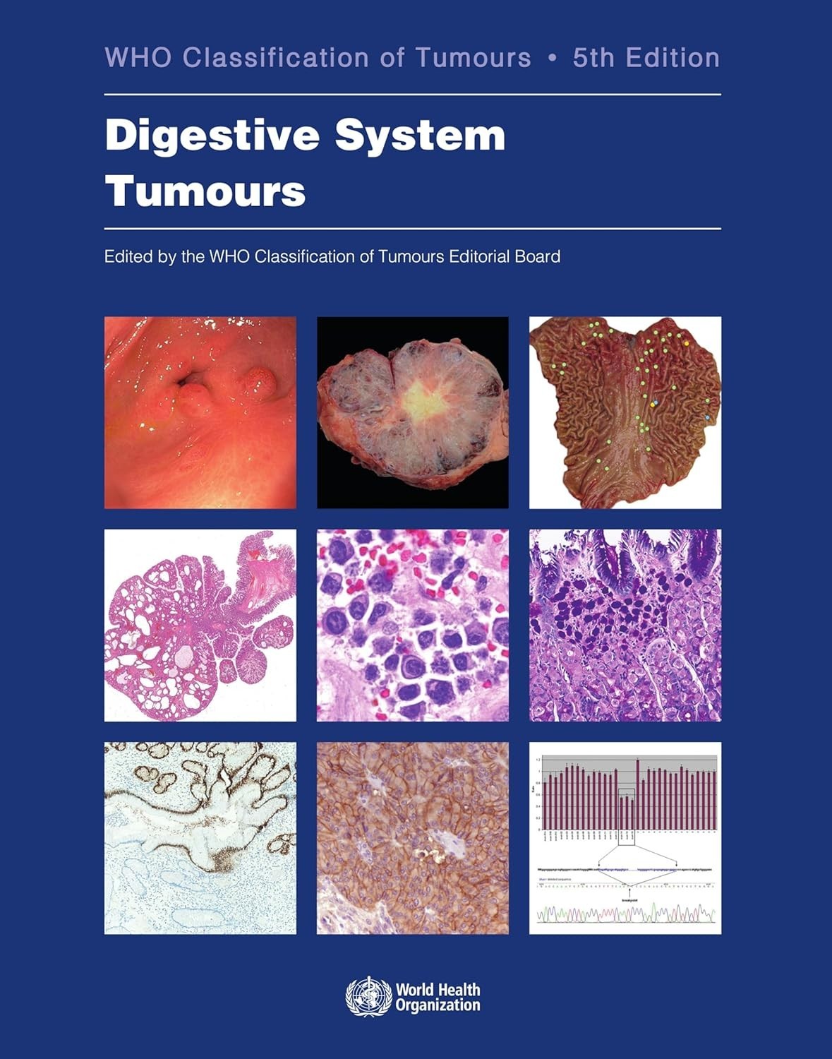 BRAND NEW Digestive System Tumours: WHO Classification of Tumors 5th Edition